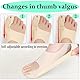 SHUOHONG 2 Stück Hallux Valgus Bandage, Ultradünner Stoff Hallux Valgus Korrektur, Passt Sich der Fußform an Hallux Valgus Schiene Unisex Verwendet für Turnschuhe Flache Schuhe High Heels 40-45