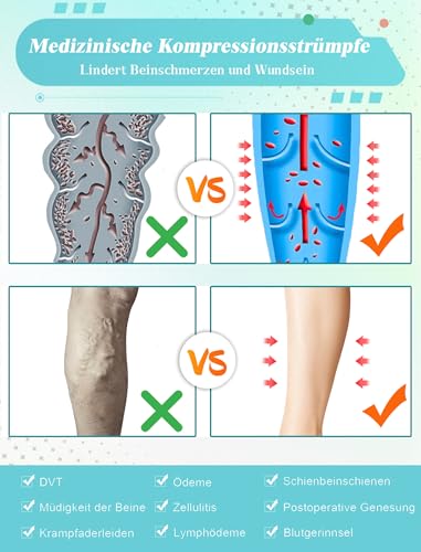 20-30 mmHg Medizinische Kompressionsstrümpfe Damen Herren, Klasse 2 Oberschenkel Lang Stützstrümpfe, Geschlossene Zehe Thrombosestrümpfe Damen mit Silikonband für Krampfadern, Ödeme, Flug