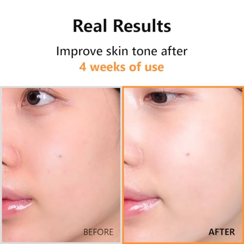 IsNtree Hyper Vitamin C 23 Serum | 23% Pure Vitamin C + Vitamin E & Panthenol for Face beauty I Korean skin care and Made in Korea