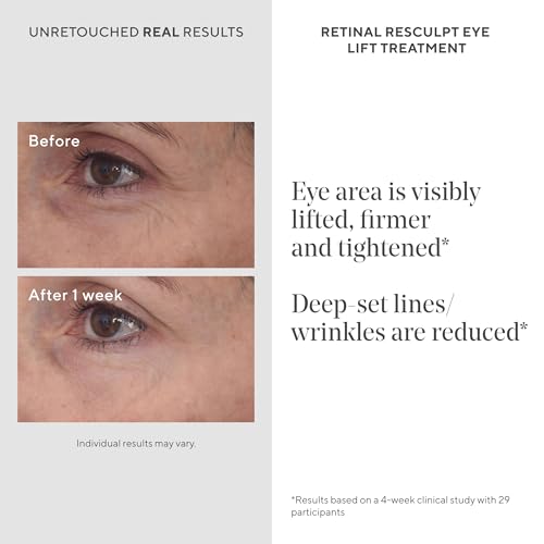 Murad 15426 Retinal Resculpt Eye Lift Treatment - Anti-Aging Eye Cream Lifts And Improves Sagging thumb #2