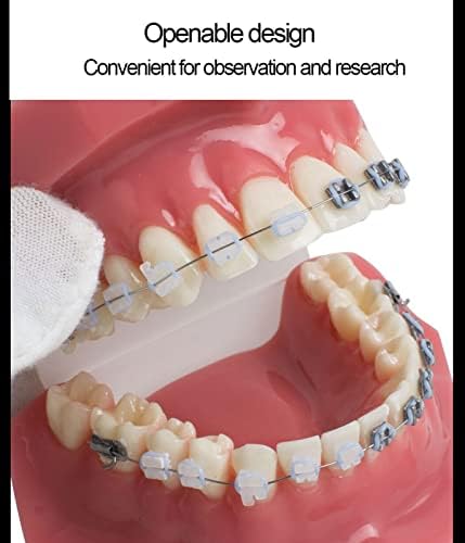 Modelli di Denti per Studenti di Odontoiatria, Modello Dentale Modello Ortodontico con Apparecchi in Ceramica E Metallo, Ottimo per L'insegnamento Scolastico E L'apprendimento degli Studenti, Mate