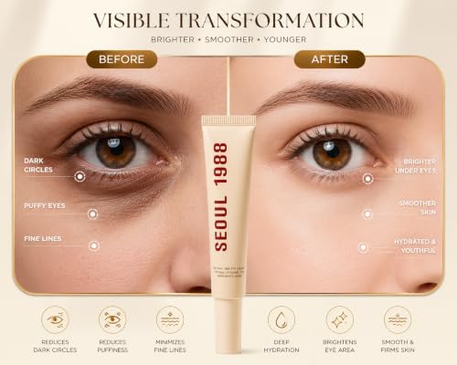 Image of SEOUL 1988 (Eye cream) Under Eye Retinal Cream for Dark Circles, Fine Lines & Puffy Eyes | Korean Eye Cream with Retinal Liposome 4% & Fermented Bean Extract | Hydrating Anti-Aging Eye Care, 30ml