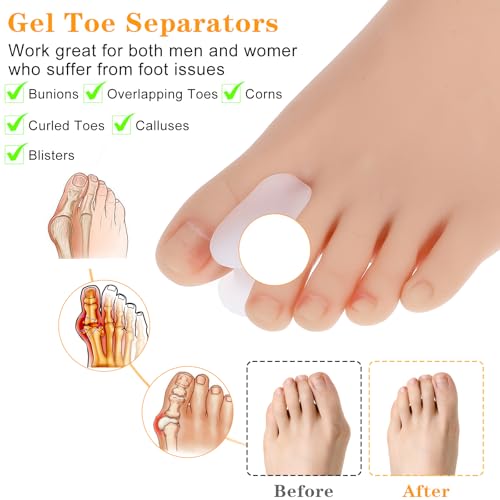Image of Gjinxi 12 Pack Gel Toe Spacers, Toe Separators for Women Men Bunion Corrector Toe Spreaders Soft Toe Straightener for Crooked Toes, Overlapping Toes, Hammertoe Correction(6L+6S)