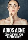  Adios Acné: Como Quitar El Acné Naturalmente