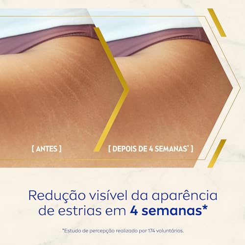 NIVEA LUMINOUS 630® Creme Corporal Antimarcas 200ml