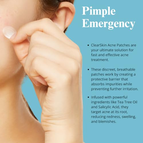 Adesivos hidrocolóides de espinhas para acne – Tratamento pontual ultraeficaz para acne, manchas e e