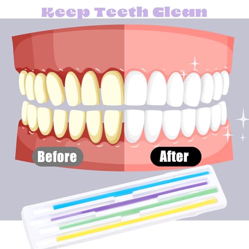 Qianyu 60 Stück Zahnschleifpapier für Zwischenräume Zahn Schleifpapier Dental Schleifstreifen Zahn Polierstreifen Zähne Polieren Finishing Gloss Contouring Tool Kit Für Die Tiefenreinigung Von Zähnen