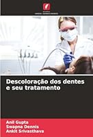 Descoloração dos dentes e seu tratamento (Portuguese Edition) 6206764923 Book Cover