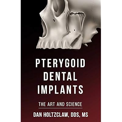 Pterygoid Implants