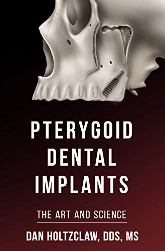 Pterygoid Implants: The Art and Science product thumbnail 2