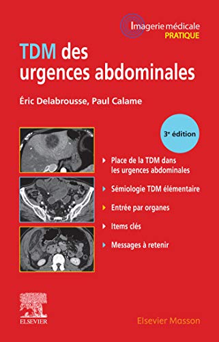  TDM des urgences abdominales (Imagerie médicale : pratique) Francais PDF