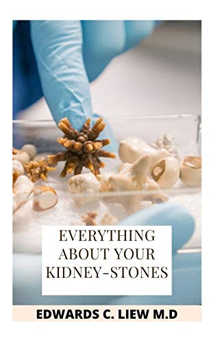 EVERYTHING ABOUT YOUR KIDNEY-STONES