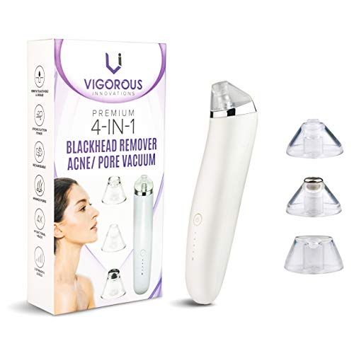 Blackhead Remover Vacuum– Dermal Care Pore Vacuum– Facial Kit With Video Guide– Face Cleaner– Men's and women's Skin Care– Acne and Dead Skin Remover– Comedo Suction– 4 Heads and 3 Strengths (white)