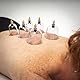 SCHRÖPFEN SET [12 Stück] Schröpfen Gläser Set mit Vakuumpumpe zur Schröpfen Massage