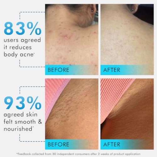 Image of mCaffeine Smooth & Odour-Free Body Duo | 7% Exfoliating Body Wash | Reduces Body Acne & Ingrown Hair | 3-in-1 Perfume Body Wash - Odour Control | Long Lasting Aqua Fresh Fragrance | 2% Salicylic Acid
