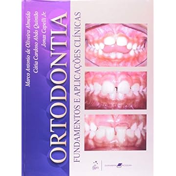Capa do livro Ortodontia Fundamentos e Aplicações Clínicas