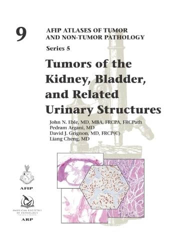 Tumors of the Kidney, Bladder, and Related Urinary Structures (AFIP Atlases of Tumor and Non-tumor Pathology, Series 5)