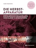 Die Herbst-Apparatur: Erfolgreiche Behandlung von Klasse-II-Dysgnathien