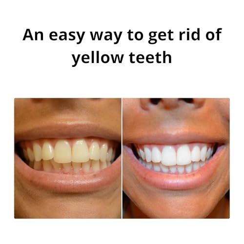 Image of Teeth Whitening Foam with Purple Color Correcting Technology - 50ml Gentle Formula for Daily Use, Stain Removal, Mint Flavor, Safe for Sensitive Teeth, Enamel-Friendly Whitening