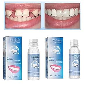 Tandreparatiekorrels voor tanden, tijdelijke tandreparatieset, vormbare valse tanden, tijdelijke tandreparatieset voor het vullen van de ontbrekende gebroken tand, gebroken tandlijm nieuwe tandreparatie (2 stuks – 30 ml)