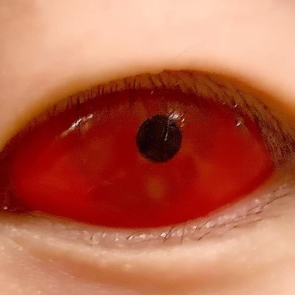 Lentille de contact Sclérale Narrow Red Halloween et Cosplay sans correction 1 an
