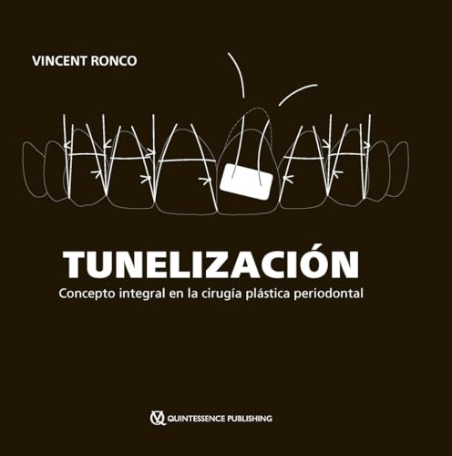 Tunelización: Concepto integral en la cirugía plástica periodontal