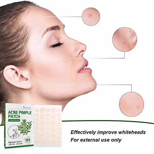 Adesivos para acne, 144 adesivos para acne que são à prova d'água e seguros para viajar para casa