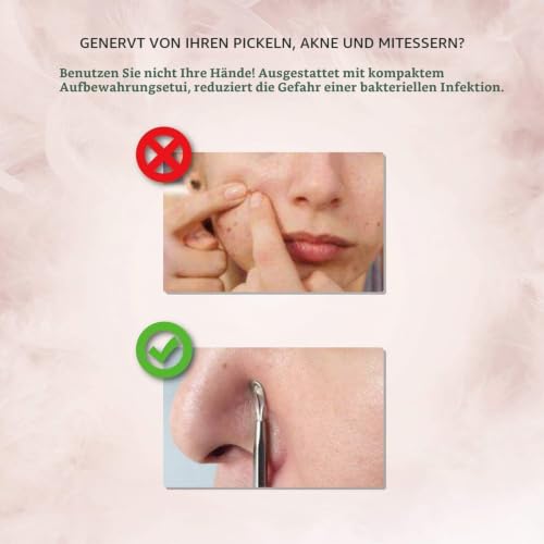 Foto von Mitesserentferner Pickel Ausdrücken Werkzeug Bonus Inkl. IZUKU Blackhead Remover aus Edelstahl 6 Stk. Comedone Extractor Akne Mitesser Pickel Entferner Komedonenquetscher Set für Alle Hauttypen