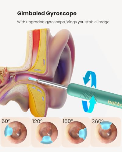 Image of BEBIRD R1 Wax Removal Tool for Ear - Spade Ear Canal Cleaner with Camera 1080P Earscope, Wax Remove Ear Picker with Vari Replacement Tips, Camera with 6LED Light, Green