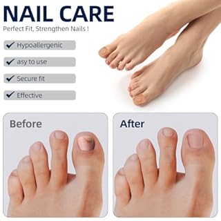 AOOWU Cerotti per la Riparazione Delle Unghie, 64 Pezzi Toppe Fungine per Unghie, Funghi Unghie Piedi, Trattamento Antifungino per Unghie, per Riparare Unghie Spaccate, Rafforzare le Unghie