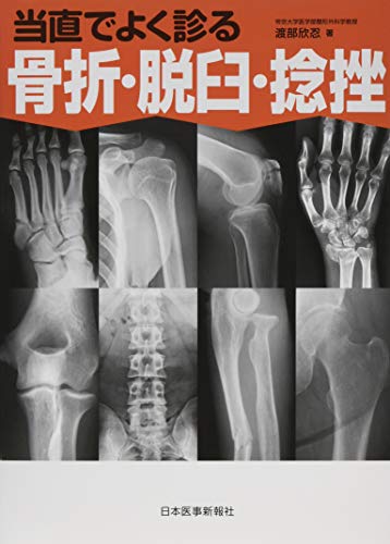当直でよく診る骨折・脱臼・捻挫《研修医☆万里小路尚子の当直サバイバル日誌》 - 渡部 欣忍
