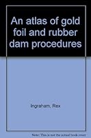 An atlas of gold foil and rubber dam procedures B0007F339I Book Cover