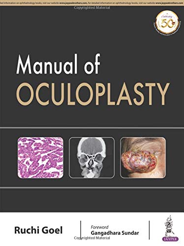 Manual of Oculoplasty