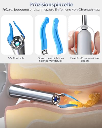 Ohrenreiniger mit Kamera - Professioneller 360° WIFI Ohrreiniger für Erwachsene | Schmerzloses Otoskop mit Pinzette | IP67 wasserdichter Design & hygienische Selbstreinigung zu Hause