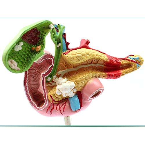 Modèle anatomique du pancréas pour expliquer les pathologies aux patients - 4