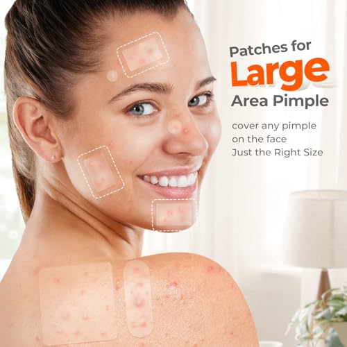 TKTK Large Pimple Patches — 142 Count, 7 Sizes — view 3