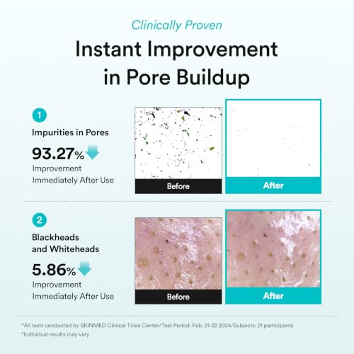 Image of Abib Green LHA Pore Pad Clear Touch - BHA Exfoliating Toner Pads for Pore Care, Sebum Control & Skin Texture Refining, Korean Skincare, 70 Pads 230mL