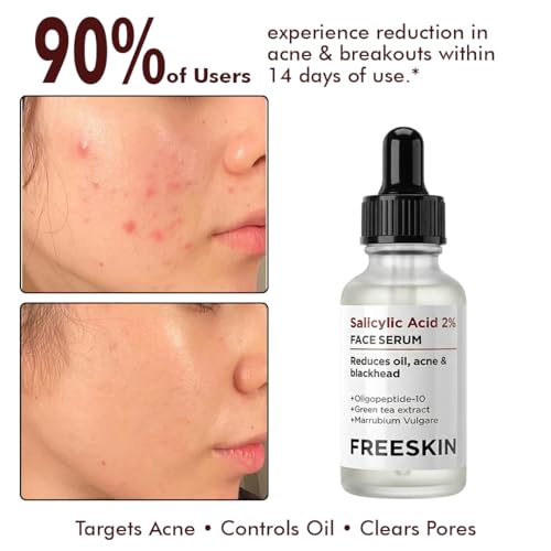 Image of Freeskin 2% Salicylic Acid Face Serum for Oil Control, Blackhead Removal & Anti-Acne Care | Skin Refinement, Hydration & Repair | Suitable for All Skin Types | 30ml