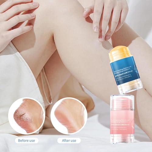 2 Piezas Crema Urea 60% para Pies y Manos - Crema Reparadora Intensiva para Talones Secos y Agrietados, Tratamiento Exfoliante de Durezas y Callos, Hidratante Profunda - imagen 4