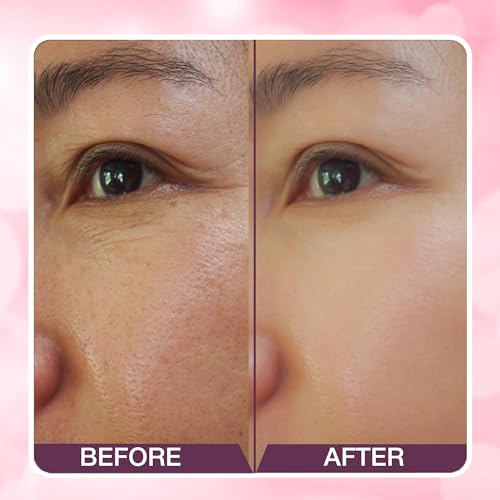 Hilary Rhoda Power of Blur Primer | Lightweight & Silicone-Based Primer | Matte Finish & Oil-Control Primer | Infused with Vitamin A & E | Water-Proof & Smoothening Primer |... - Image 6