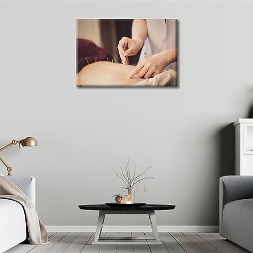Image of Wall Painting Acupuncture and Moxibustion Paintings for Wall Decorations 1 Panels Physical Therapists do Acupuncture Wall Art Giclee Wooden Framed Gallery-Wrapped Ready to Hang (12 inch Wx18 H)