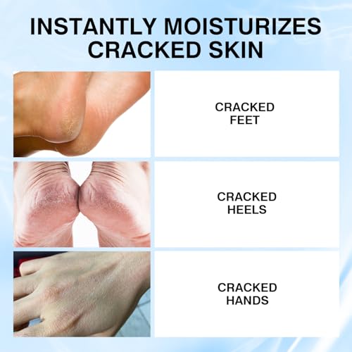 Professional Repair Heel Balm Stick for dry cracked feet treatment, intensive foot repair, moisturizes heels, deeply moisturizes and softens feet, refreshingly smooth non-greasy texture - Image 5