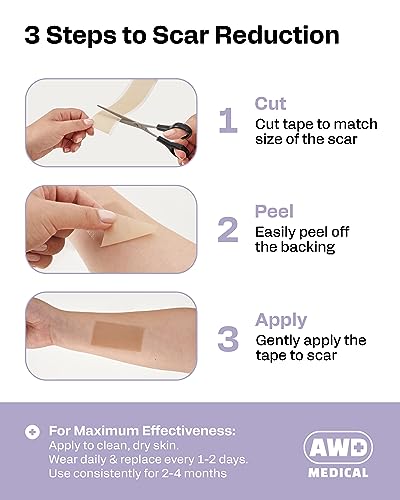 awd silicone scar sheets for surgical scars - seamless medical grade silicone scar tape for c section tummy tuck tape - silicone skin patches after surgery must haves 1634 x 6034 seamless roll