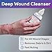 PrimaDerm Sterile Wound Cleanser, 4 oz Single Use Squirt Bottle - Non Cytotoxic Dermal Cleanser - Traumatic Acute Wound Wash - Gentle Poloxamer 188 Based Formula