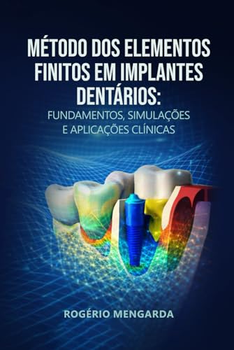 MÉTODO DOS ELEMENTOS FINITOS EM IMPLANTES DENTÁRIOS: FUNDAMENTOS, SIMULAÇÕES E APLICAÇÕES CLÍNICASMÉTODO DOS ELEMENTOS FINITOS EM IMPLANTES DENTÁRIOS (Portuguese Edition)