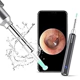 【Vielseitig】: geeignet für die tägliche Inspektion des Gehörgangs, des Mundes, des Zahnfleischs, der Nase, der Kopfhaut, der Haarwurzeln und anderer Körperteile, das Otoskop ist voll kompatibel mit Smartphones, Tablets, iOS und Android.