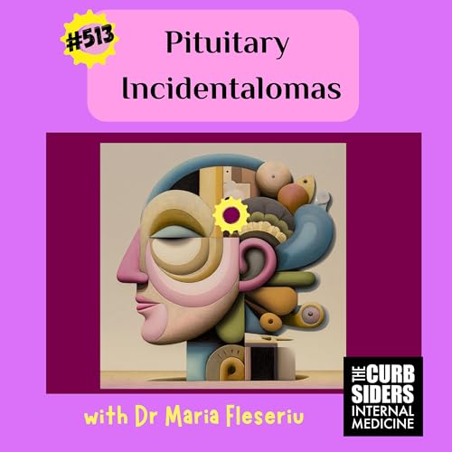#513 Pituitary Incidentalomas