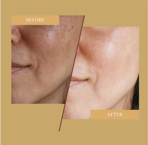 Galaglo Skincare Pure Saffron Serum With 24K Gold Flakes, Intense Hydration + Natural Moisture, Reduce Dark Spots, Wrinkles, Regenerates Cells & Restore Elasticity With Hyaluronic Acid (30 Ml/1 Fl Oz) #TOP4