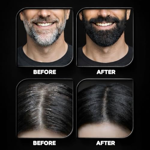 Image of PARISAR Hair Cover Up Powder Black 4g (Pack of 3) | Hair Root Touch Up | Natural Hairline Powder | Bald Spot Cover for Women & Men | Matte Finish