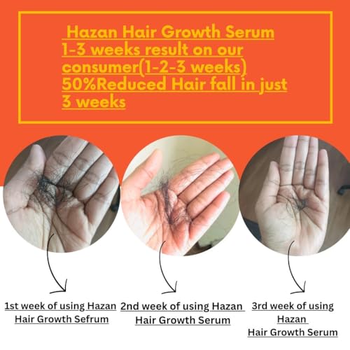 Image of Hazan Hair Growth Serum With 4-in-1 Advanced Formulation-Redensyl + Anagain + Niacinamide + Caffeine | Boosts Hair Growth & Density | Prevents Hair Fall by 90%,tested on Real individuals | Prevents Rough,Frizzy Hairs,Restores Smoothness | Non-Greasy | For Men & Women | 30ml